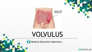 Medical Education Laboratory
VOLVULUS
 
