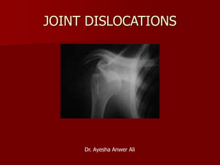 JOINT DISLOCATIONS
Dr. Ayesha Anwer Ali
 