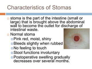 3. Caring for the patient undergoing ostomy surgery.pptx