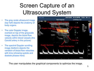 color doppler | PPT