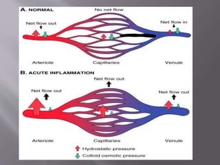 Inflammation Reflection 3.inflammation 1-1.pptx