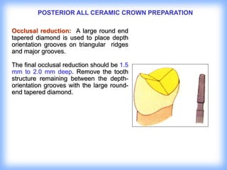 3. TOOTH PREPRATION.ppt