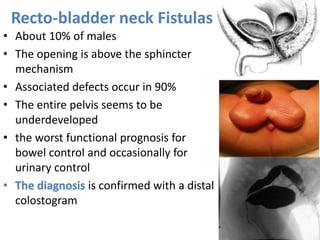 3.Management of HSD and ARM.pptx