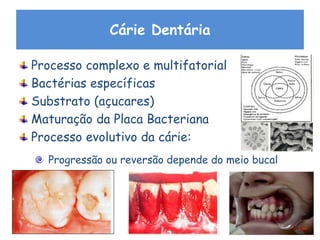 Cárie Dentária
Processo complexo e multifatorial
Bactérias específicas
Substrato (açucares)
Maturação da Placa Bacteriana
Processo evolutivo da cárie:
Progressão ou reversão depende do meio bucal
 