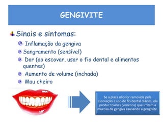 GENGIVITE
Sinais e sintomas:
Inflamação da gengiva
Sangramento (sensível)
Dor (ao escovar, usar o fio dental e alimentos
quentes)
Aumento de volume (inchada)
Mau cheiro
Se a placa não for removida pela
escovação e uso de fio dental diários, ela
produz toxinas (venenos) que irritam a
mucosa da gengiva causando a gengivite.
 