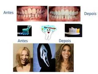 Antes Depois
Antes Depois
 