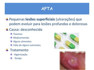 AFTA
Pequenas lesões superficiais (ulcerações) que
podem evoluir para lesões profundas e dolorosas
Causa: desconhecida
Traumas
Medicamentos
Alguns alimentos
Falta de alguns nutrientes
Tratamento
Higienização
Tempo
 