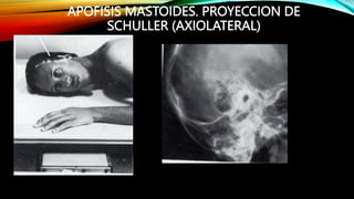 3 2 ANATOMIA Y RADIOLOGIA DE CRANEO PARTE II pptx