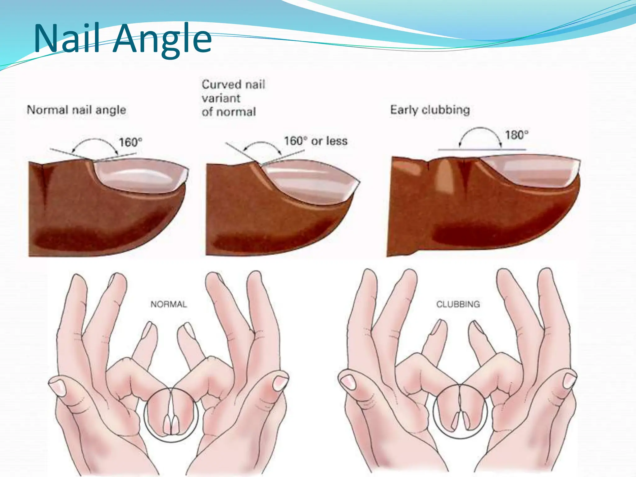 3.Skin, Hair & Nail Assessment.ppt Nursing | PPT