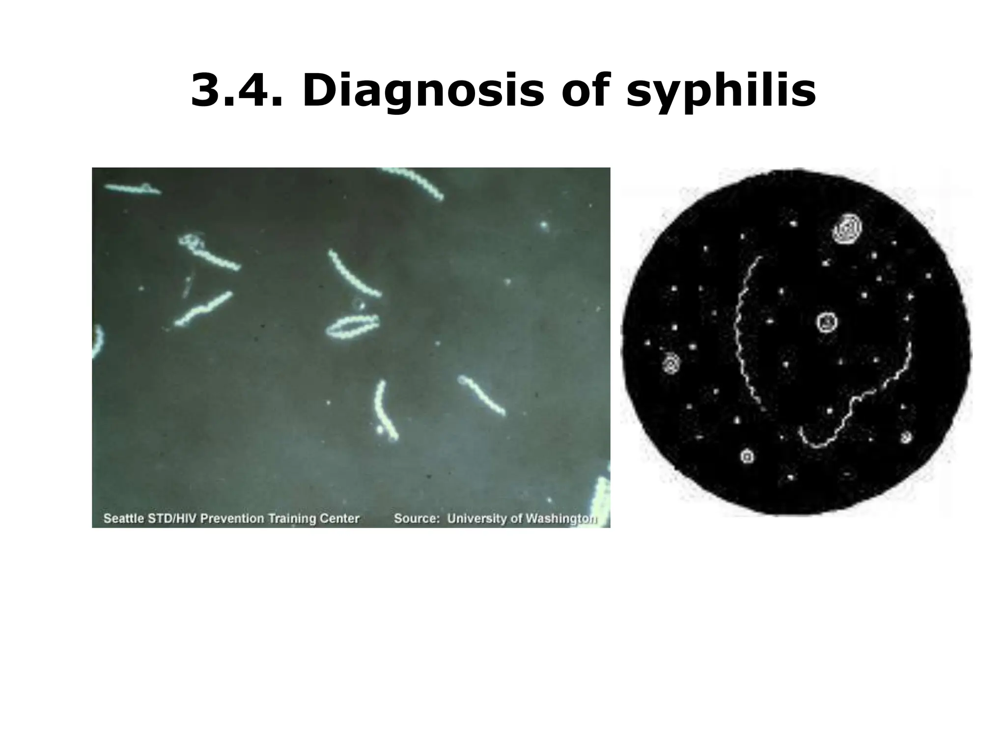 Syphilis Serology serological test for medical laboratory.ppt