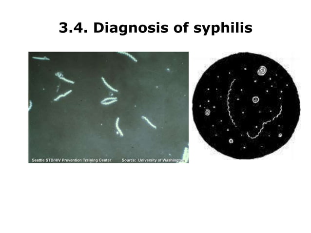 Syphilis Serology serological test for medical laboratory.ppt