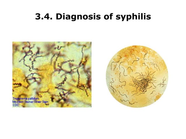 Syphilis Serology serological test for medical laboratory.ppt