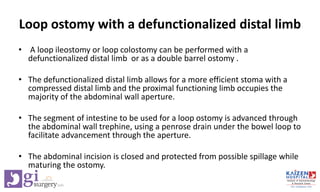 3.6 Stoma techniques of construction.pdf