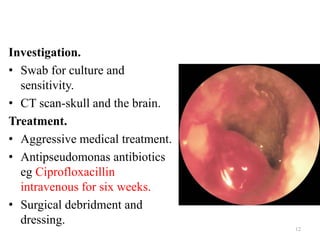 Investigation.
• Swab for culture and
sensitivity.
• CT scan-skull and the brain.
Treatment.
• Aggressive medical treatment.
• Antipseudomonas antibiotics
eg Ciprofloxacillin
intravenous for six weeks.
• Surgical debridment and
dressing.
12
 