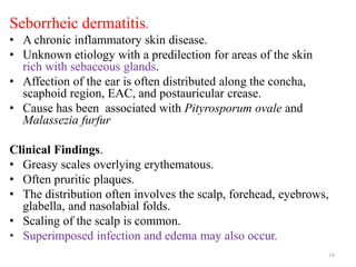 Seborrheic dermatitis.
• A chronic inflammatory skin disease.
• Unknown etiology with a predilection for areas of the skin
rich with sebaceous glands.
• Affection of the ear is often distributed along the concha,
scaphoid region, EAC, and postauricular crease.
• Cause has been associated with Pityrosporum ovale and
Malassezia furfur
Clinical Findings.
• Greasy scales overlying erythematous.
• Often pruritic plaques.
• The distribution often involves the scalp, forehead, eyebrows,
glabella, and nasolabial folds.
• Scaling of the scalp is common.
• Superimposed infection and edema may also occur.
16
 