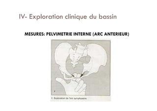 3.Bassin obstétrical.pdf pour votre santé | PDF