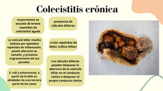 mayormente es
secuela de brotes
repetidos de
colecistitis aguda
presencia de
cálculos biliares
La vesícula billar resulta
dañada por episodios
repetidos de inflamación,
puede alterarse su
tamaño, y presenta
engrosamiento de sus
paredes.
crisis repetidas de
dolor (cólico biliar)
Los cálculos biliares
pueden bloquear la
abertura de la vesícula
biliar en el conducto
cístico o bloquear el
propio conducto cístico
E. coli y enterococos, a
partir de la bilis en
alrededor de una tercera
parte de los casos
Colecistitis crónica
 