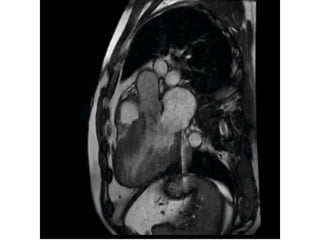 3.4 Cardiac MRI and CT in cardiology for evaluation | PDF
