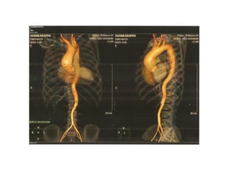 3.4 Cardiac MRI and CT in cardiology for evaluation | PDF