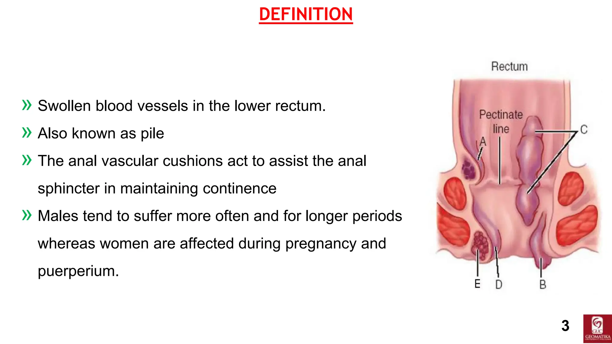 Urectum HAEMORRHOIDS MEDICAL ASSISTANT NURSING PPTX | PPTX