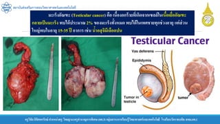 ครูวิชัยลิขิตพรรักษ์ ตาแหน่งครู วิทยฐานะครูชานาญการพิเศษ(คศ.3)กลุ่มสาระการเรียนรู้วิทยาศาสตร์และเทคโนโลยี โรงเรียนวัดราชบพิธ สพม.กท.1
สถาบันส่งเสริมการสอนวิทยาศาสตร์และเทคโนโลยี
มะเร็งอัณฑะ (Testicular cancer) คือ เนื้องอกร้ายที่เกิดจากเซลล์ในเนื้อเยื่ออัณฑะ
กลายเป็นมะเร็ง พบได้ประมาณ 2% ของมะเร็งทั้งหมด พบได้ในเพศชายทุกช่วงอายุ แต่ส่วน
ใหญ่พบในอายุ 15-35 ปี อาการ เช่น น้าอสุจิมีเลือดปน
 