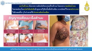 ครูวิชัยลิขิตพรรักษ์ ตาแหน่งครู วิทยฐานะครูชานาญการพิเศษ(คศ.3)กลุ่มสาระการเรียนรู้วิทยาศาสตร์และเทคโนโลยี โรงเรียนวัดราชบพิธ สพม.กท.1
สถาบันส่งเสริมการสอนวิทยาศาสตร์และเทคโนโลยี
มะเร็งเต้านม เกิดจากความผิดปกติของเซลล์ในเต้านม โดยเฉพาะเซลล์ท่อน้านม
โดยเซลล์จะเริ่มแบ่งตัวผิดปกติแล้วลุกลามไปยังเนื้อเยื่อข้างเคียง หากปล่อยไว้อาจแพร่กระจาย
ไปยังเซลล์อื่น ๆ ในร่างกายได้ ผ่านทางเดินน้าเหลือง
 