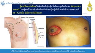 ครูวิชัยลิขิตพรรักษ์ ตาแหน่งครู วิทยฐานะครูชานาญการพิเศษ(คศ.3)กลุ่มสาระการเรียนรู้วิทยาศาสตร์และเทคโนโลยี โรงเรียนวัดราชบพิธ สพม.กท.1
สถาบันส่งเสริมการสอนวิทยาศาสตร์และเทคโนโลยี
ผู้ชายเป็นมะเร็งเต้านมได้เช่นเดียวกับผู้หญิง ซึ่งมีสาเหตุคล้ายกัน เช่น พันธุกรรมใน
ครอบครัว โดยผู้ชายมีโอกาสเป็นเมื่อเทียบกับจานวนผู้หญิงที่เป็นมะเร็งเต้านม 100 คน จะมี
0.5-1 % เท่านั้น ซึ่งถือว่าพบได้น้อยมาก
 
