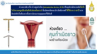 ครูวิชัยลิขิตพรรักษ์ ตาแหน่งครู วิทยฐานะครูชานาญการพิเศษ(คศ.3)กลุ่มสาระการเรียนรู้วิทยาศาสตร์และเทคโนโลยี โรงเรียนวัดราชบพิธ สพม.กท.1
สถาบันส่งเสริมการสอนวิทยาศาสตร์และเทคโนโลยี
ห่วงอนามัย หรือ ห่วงคุมกาเนิด (Intrauterine device, IUD) เป็นอุปกรณ์ขนาดเล็กใส่เข้า
ในโพรงมดลูกป้องกันฝังตัวอ่อนตั้งครรภ์ ซึ่งปลอดภัยและประสิทธิภาพดี ใช้ได้นาน 3-10 ปี หาก
ผิดปกติหรือต้องการตั้งครรภ์สามารถถอดออกได้ทันที
 