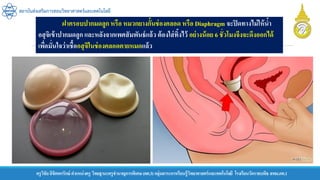 ครูวิชัยลิขิตพรรักษ์ ตาแหน่งครู วิทยฐานะครูชานาญการพิเศษ(คศ.3)กลุ่มสาระการเรียนรู้วิทยาศาสตร์และเทคโนโลยี โรงเรียนวัดราชบพิธ สพม.กท.1
สถาบันส่งเสริมการสอนวิทยาศาสตร์และเทคโนโลยี
ฝาครอบปากมดลูก หรือ หมวกยางกั้นช่องคลอด หรือ Diaphragm จะปิดทางไม่ให้น้า
อสุจิเข้าปากมดลูก และหลังจากเพศสัมพันธ์แล้ว ต้องใส่ทิ้งไว้ อย่างน้อย 6 ชั่วโมงจึงจะดึงออกได้
เพื่อมั่นใจว่าเชื้ออสุจิในช่องคลอดตายหมดแล้ว
 
