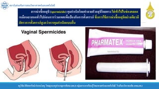 ครูวิชัยลิขิตพรรักษ์ ตาแหน่งครู วิทยฐานะครูชานาญการพิเศษ(คศ.3)กลุ่มสาระการเรียนรู้วิทยาศาสตร์และเทคโนโลยี โรงเรียนวัดราชบพิธ สพม.กท.1
สถาบันส่งเสริมการสอนวิทยาศาสตร์และเทคโนโลยี
สารฆ่าเชื้ออสุจิ (spermicide) คุมกาเนิดโดยทาลายตัวอสุจิโดยตรงใส่เข้าไปในช่องคลอด
เหมือนยาสอดทั่วไปก่อนการร่วมเพศเพื่อป้องกันการตั้งครรภ์ ซึ่งการใช้สารฆ่าเชื้ออสุจิอย่างเดียวมี
อัตราการตั้งครรภ์สูงกว่าการคุมกาเนิดแบบอื่น
 