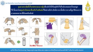 ครูวิชัยลิขิตพรรักษ์ ตาแหน่งครู วิทยฐานะครูชานาญการพิเศษ(คศ.3)กลุ่มสาระการเรียนรู้วิทยาศาสตร์และเทคโนโลยี โรงเรียนวัดราชบพิธ สพม.กท.1
สถาบันส่งเสริมการสอนวิทยาศาสตร์และเทคโนโลยี
ถุงยางอนามัยทั้งในเพศชายและหญิงป้องกันไม่ให้อสุจิเข้าไปในช่องคลอดหรือมดลูก
ได้ ซึ่งจะช่วยคุมกาเนิดและป้องกันโรคติดต่อได้อย่างมีประสิทธิภาพเมื่อมีการสวมที่ถูกวิธีและควร
สวมตลอดเวลาที่มีเพศสัมพันธ์
 