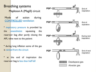 Mapleson A (Magill) circuit
Breathing systems
• inspiratory pressure is provided by
the anaesthetist squeezing the
reservoir bag after partly closing the
APL valve next to the patient
• during lung inflation some of the gas
is vented from the circuit
• at the end of inspiration the
reservoir bag is less than half full
Mode of action during
CONTROLLED ventilation
 