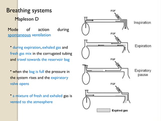 Mapleson D
Breathing systems
Mode of action during
spontaneous ventilation
• during expiration, exhaled gas and
fresh gas mix in the corrugated tubing
and travel towards the reservoir bag
• when the bag is full the pressure in
the system rises and the expiratory
valve opens
• a mixture of fresh and exhaled gas is
vented to the atmosphere
 