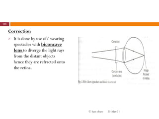 Correction
 It is done by use of/ wearing
spectacles with biconcave
lens to diverge the light rays
from the distant objects
hence they are refracted onto
the retina.
25-Mar-21
105
© Sam obare
 