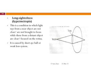 2. Long-sightedness
(hypermetropia)
 This is a condition in which light
rays from a near object are not
clear/ are not brought to focus
while those from a distant object
are clear/ focused on the retina.
 It is caused by short aye ball or
weak lens system.
25-Mar-21
106
© Sam obare
 