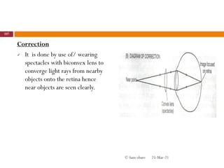 Correction
 It is done by use of/ wearing
spectacles with biconvex lens to
converge light rays from nearby
objects onto the retina hence
near objects are seen clearly.
25-Mar-21
107
© Sam obare
 