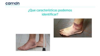 Pág. 3
¿Que características podemos
identificar?
 