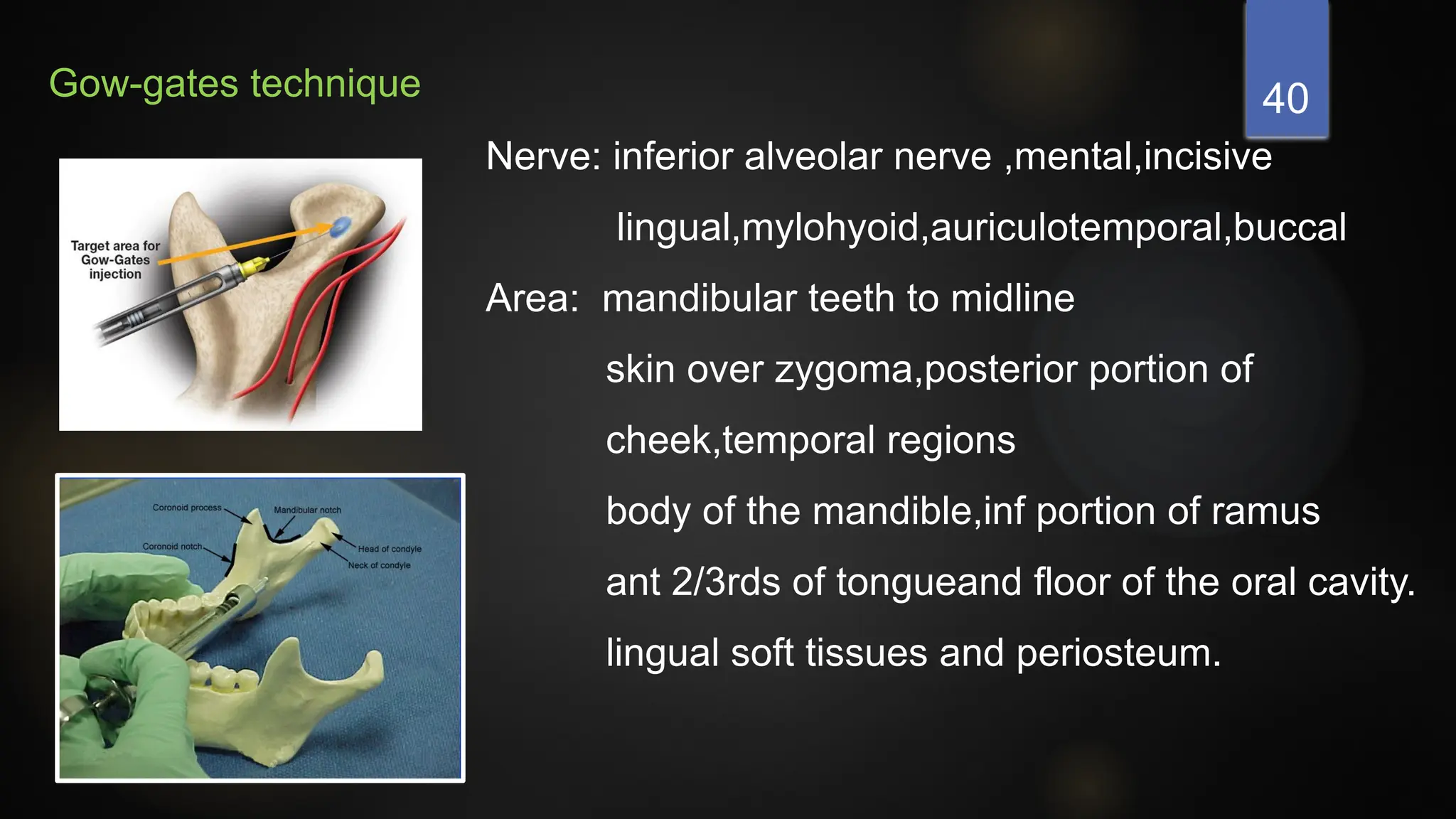 3.local anesthesia in dentistry pptx presentation | PPTX