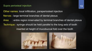19
Supra periosteal injection
Other names: local infiltration, paraperiosteal injection
Nerves : large terminal branches of dental plexus
Area : entire region innervated by terminal branches of dental plexus
Technique : syringe should be held parallel to the long axis of tooth
inserted at height of mucobuccal fold over the tooth
 