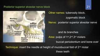 21
Posterior superior alveolar nerve block
Other names: tuberosity block,
zygomatic block
Nerve: posterior superior alveolar nerve
and its branches
Area: pulps of 1st
,2nd
,3rd
molars
buccal periodontium and bone over
these teeth
Technique: insert the needle at height of mucobuccal fold of 2nd
molar
 