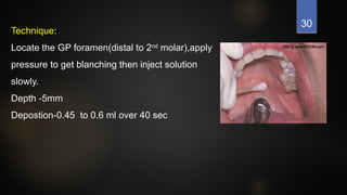 30
Technique:
Locate the GP foramen(distal to 2nd
molar),apply
pressure to get blanching then inject solution
slowly.
Depth -5mm
Depostion-0.45 to 0.6 ml over 40 sec
 