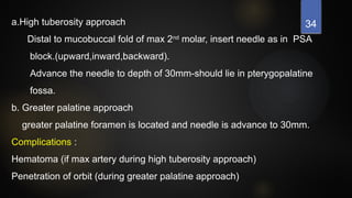 34
a.High tuberosity approach
Distal to mucobuccal fold of max 2nd
molar, insert needle as in PSA
block.(upward,inward,backward).
Advance the needle to depth of 30mm-should lie in pterygopalatine
fossa.
b. Greater palatine approach
greater palatine foramen is located and needle is advance to 30mm.
Complications :
Hematoma (if max artery during high tuberosity approach)
Penetration of orbit (during greater palatine approach)
 