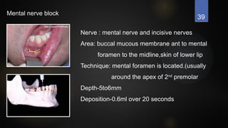 39
Mental nerve block
Nerve : mental nerve and incisive nerves
Area: buccal mucous membrane ant to mental
foramen to the midline,skin of lower lip
Technique: mental foramen is located.(usually
around the apex of 2nd
premolar
Depth-5to6mm
Deposition-0.6ml over 20 seconds
 