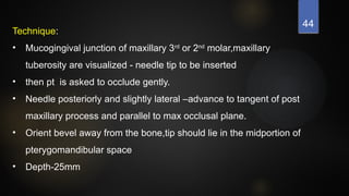 44
Technique:
• Mucogingival junction of maxillary 3rd
or 2nd
molar,maxillary
tuberosity are visualized - needle tip to be inserted
• then pt is asked to occlude gently.
• Needle posteriorly and slightly lateral –advance to tangent of post
maxillary process and parallel to max occlusal plane.
• Orient bevel away from the bone,tip should lie in the midportion of
pterygomandibular space
• Depth-25mm
 