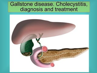 Gallbladder Calcium Gallstone disease, or cholelithiasis, refers to the formation of solid ...