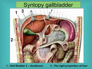 Gallbladder Calcium Gallstone disease, or cholelithiasis, refers to the formation of solid ...
