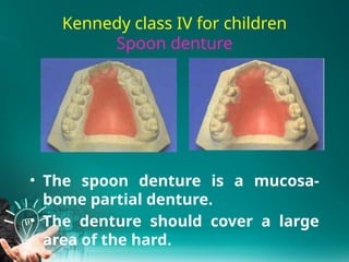 3.Principles of kennedy class III IV RPD design2025.pptx