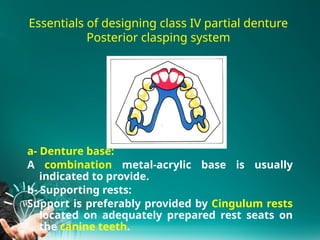 3.Principles of kennedy class III IV RPD design2025.pptx