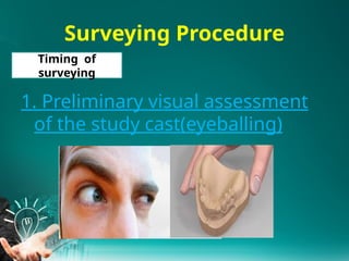 Surveying Study Cast Rpd 3.Principles of kennedy class III IV RPD design2025.pptx