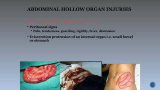 Small Intestine Injury 3.Trauma and Abdominal trauma and their complications.pptx